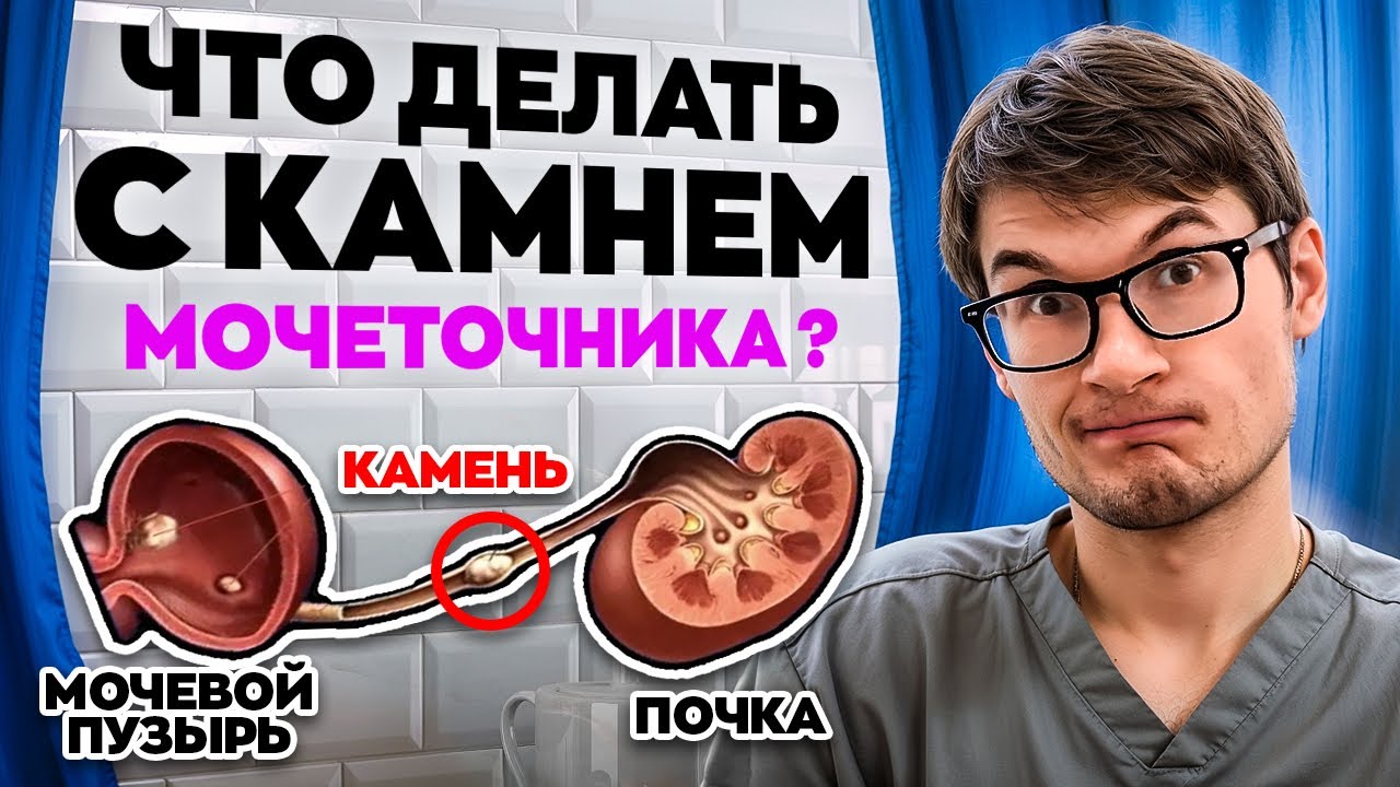 Что делать с камнем мочеточника?
