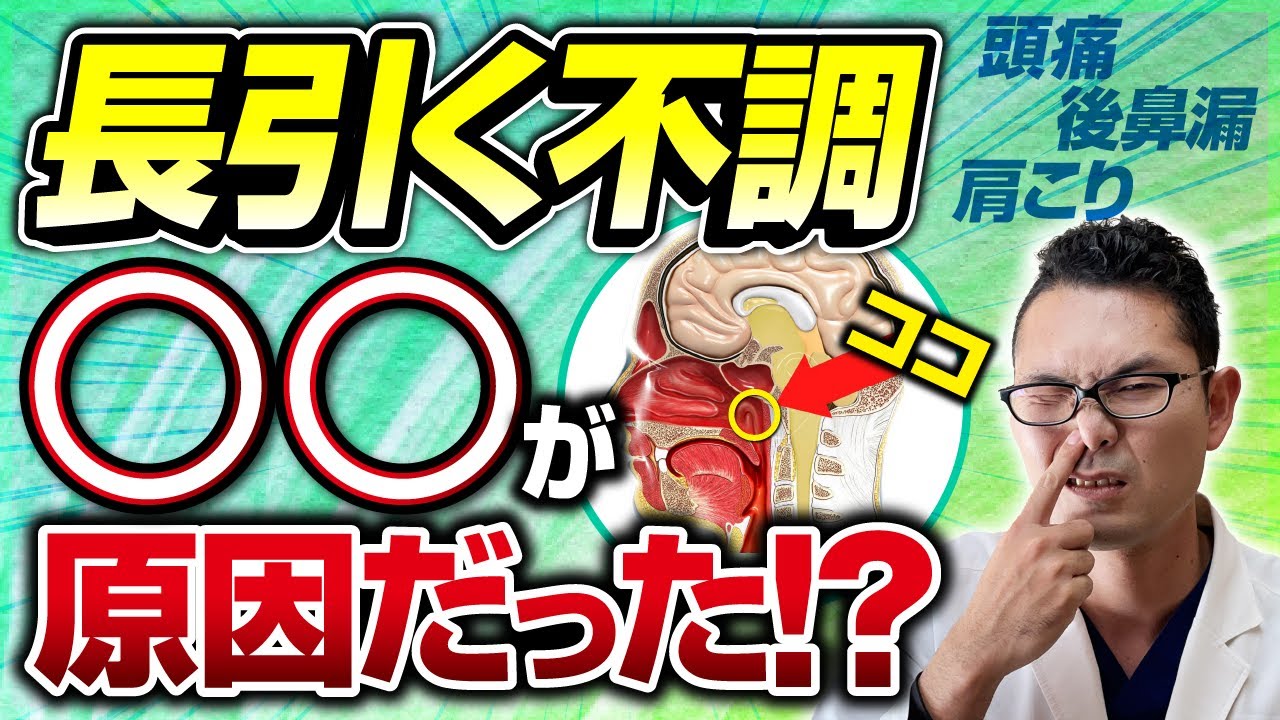 【耳鼻科医解説】長引く体調不良の原因「上咽頭炎」を解説【Bスポット治療実演】