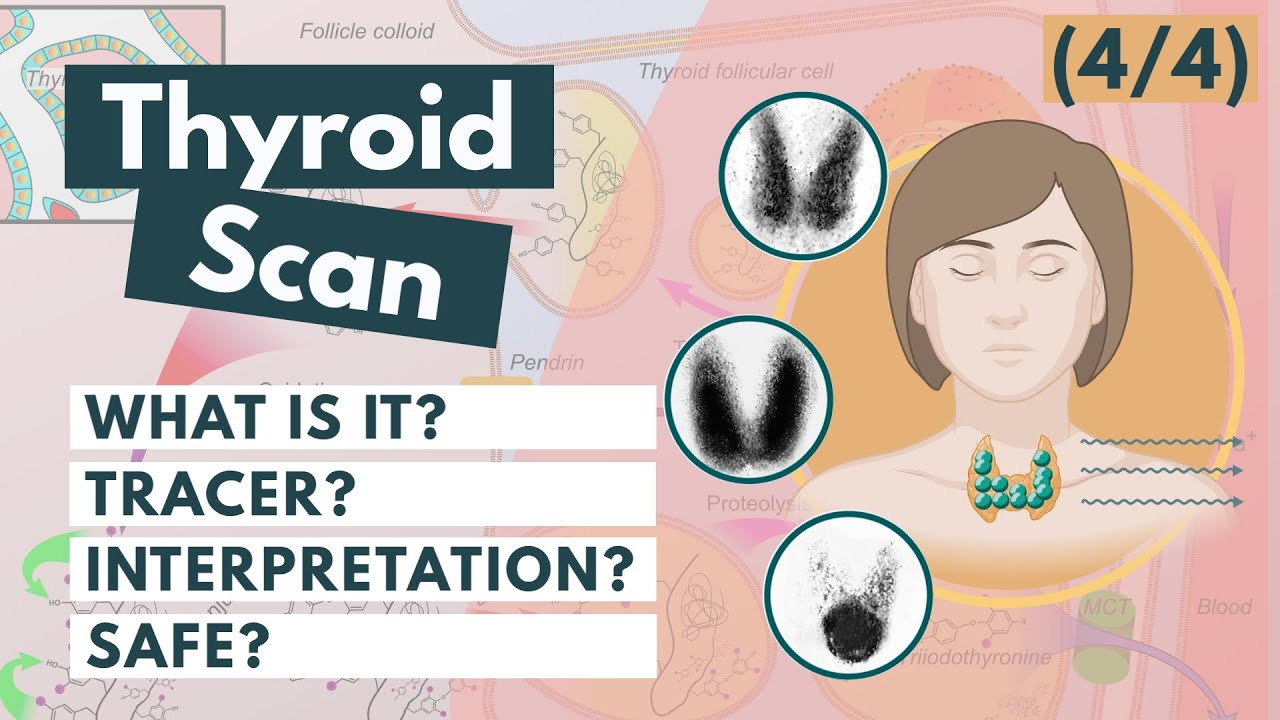 Thyroid Scan & Radioactive Iodine | Nuclear medicine | Visual Explanation