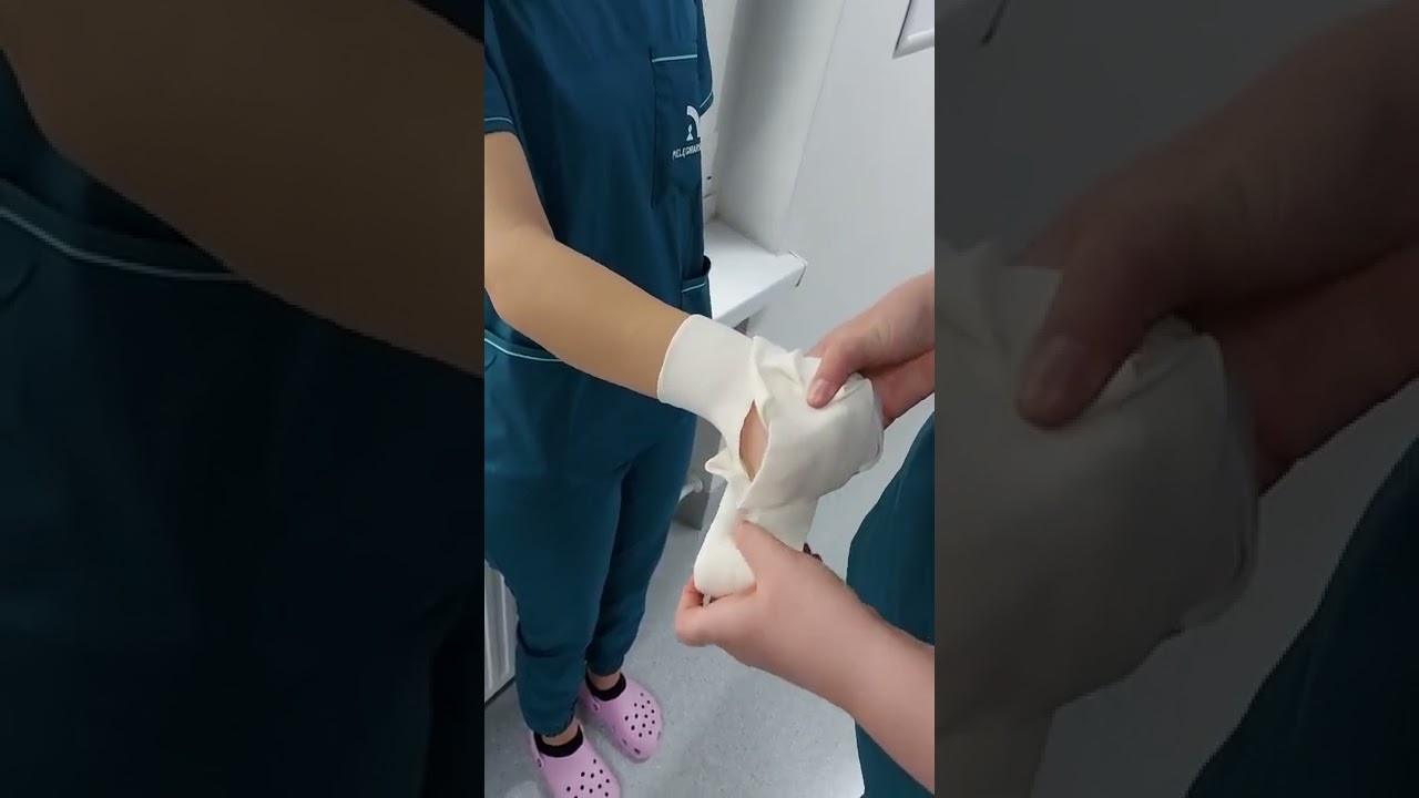 Opatrunek kłosowy pełny kikuta