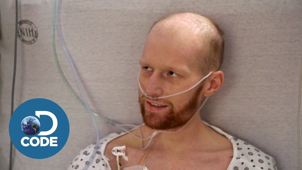 First In Human EP3 (4/6) | Complication to Deidra Williams and Bo Cooper's Treatment