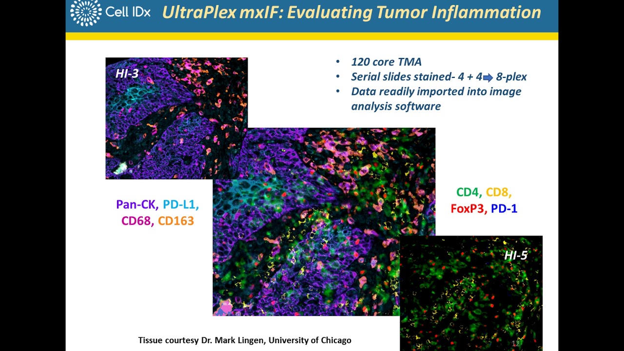 Multiplex Immunofluorescence Profiling of Tumor Biopsies Using UltraPlex mxIF Technology