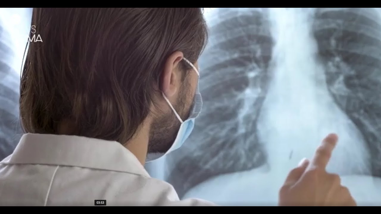 TV   Remissão Clínica  uma nova era no tratamento da asma grave   Parte II
