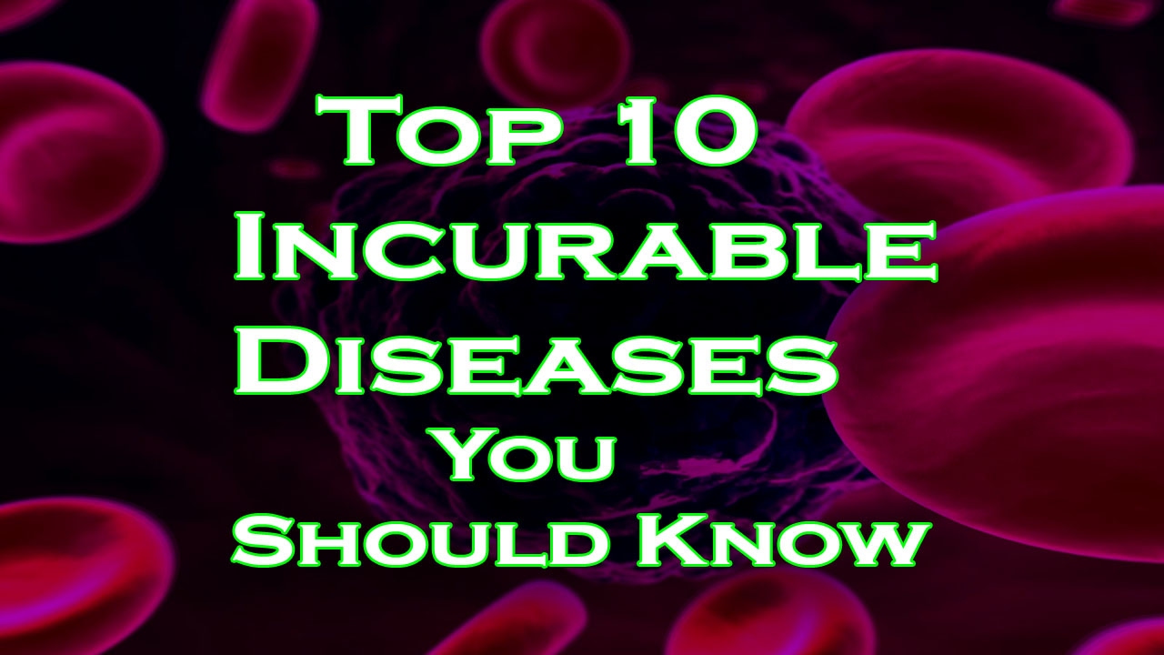 Top 10 Incurable Diseases You Should Know - Curious Mind