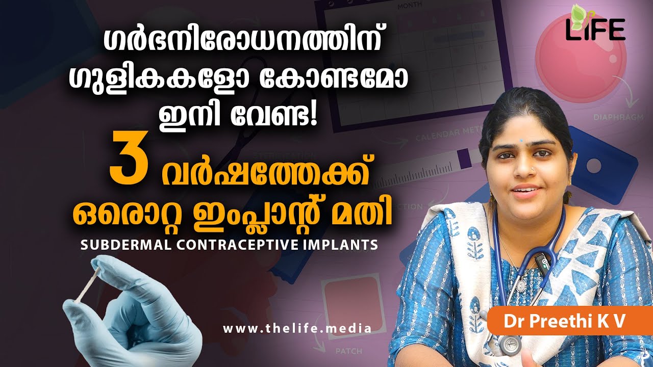 ഉപചർമ്മ ഗർഭനിരോധന ഇംപ്ലാന്റ്: 3 വർഷത്തേക്ക് സുരക്ഷിതമായത്! | Contraceptive Implant