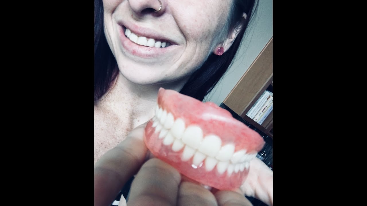 Dentures at 32 years old