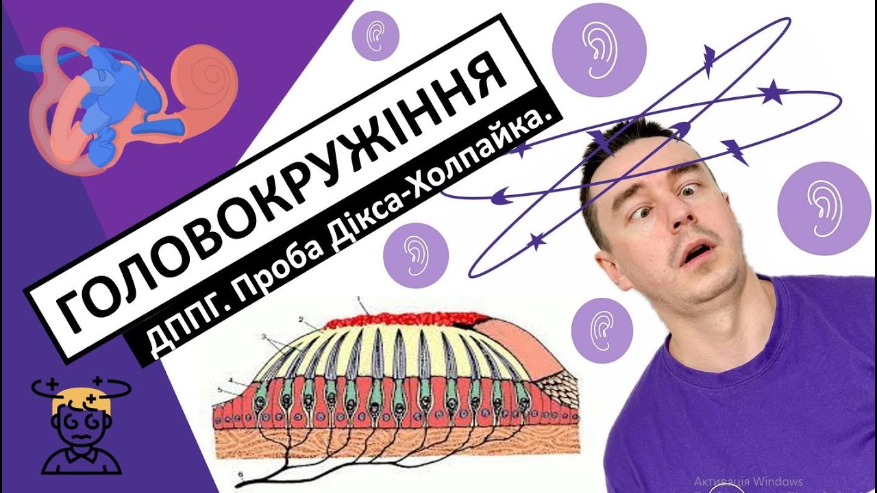 ГОЛОВОКРУЖІННЯ та запаморочення. ДППГ. Проба Дікса-Холпайка. Маневр Еплі. #головокружіння
