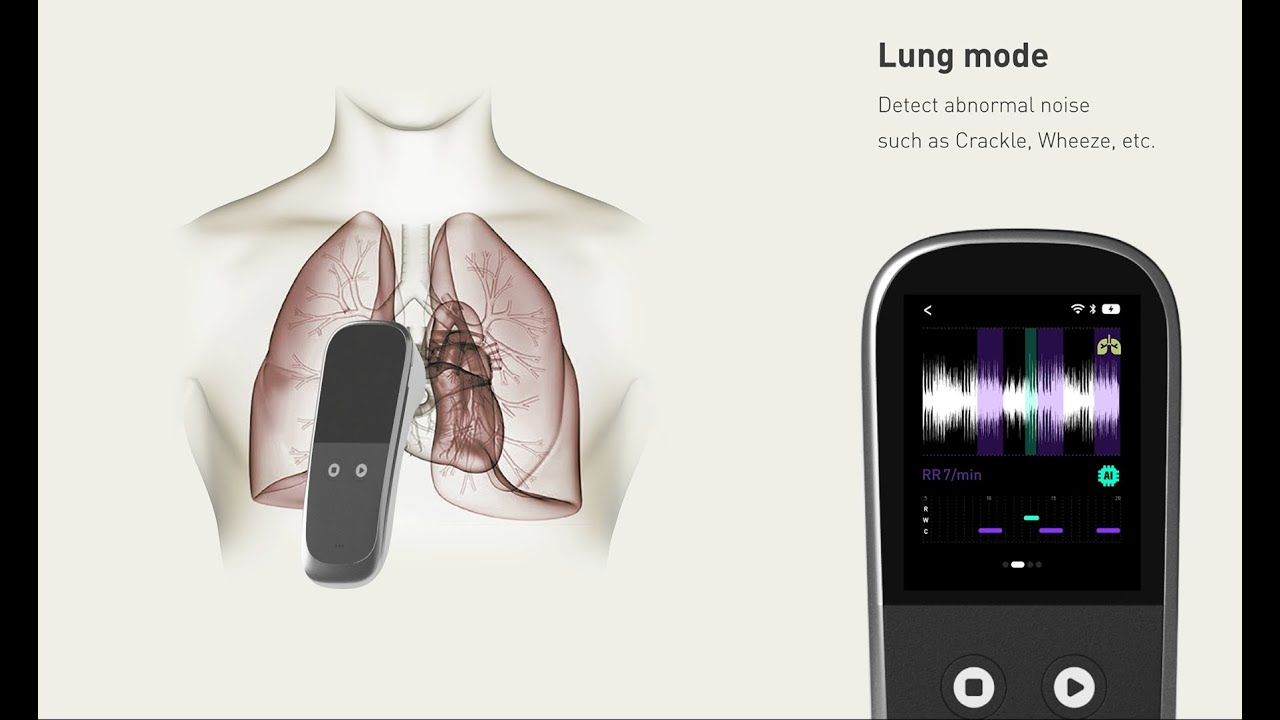 Skeeper R1 - Edge AI Smart Stethoscope