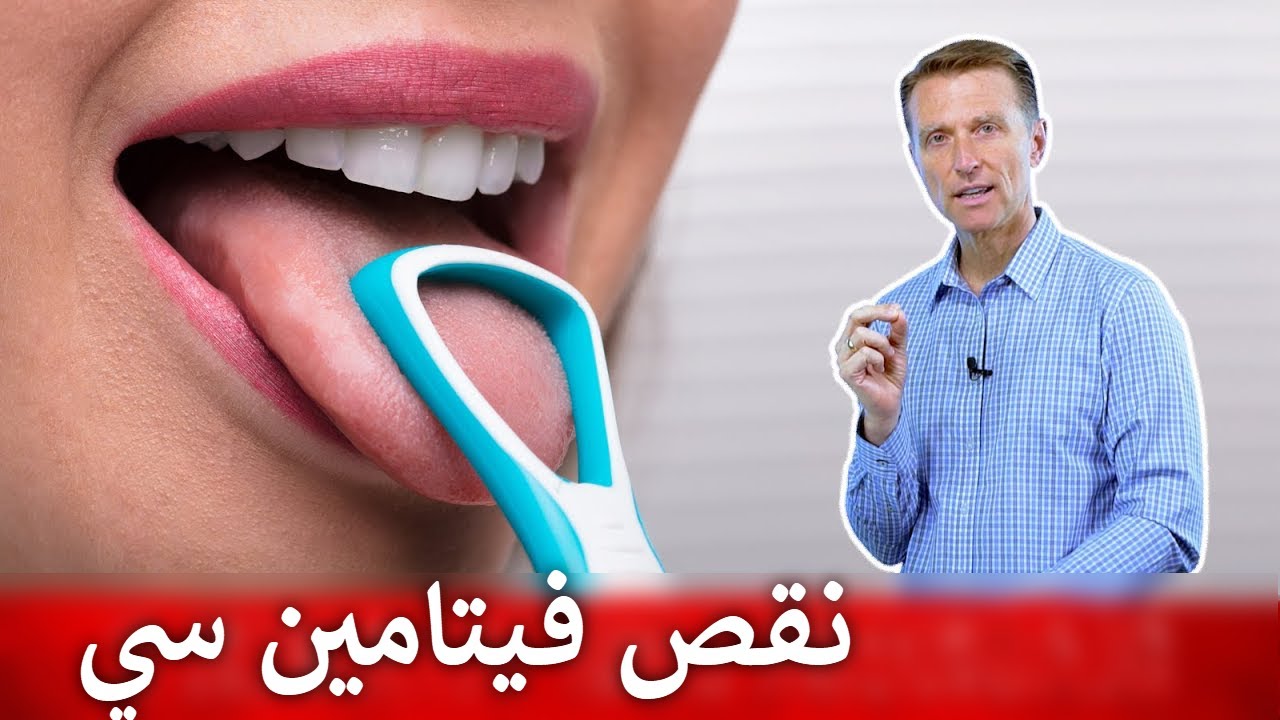 اللسان | تحديد نقص فيتامين سي من شكل اللسان