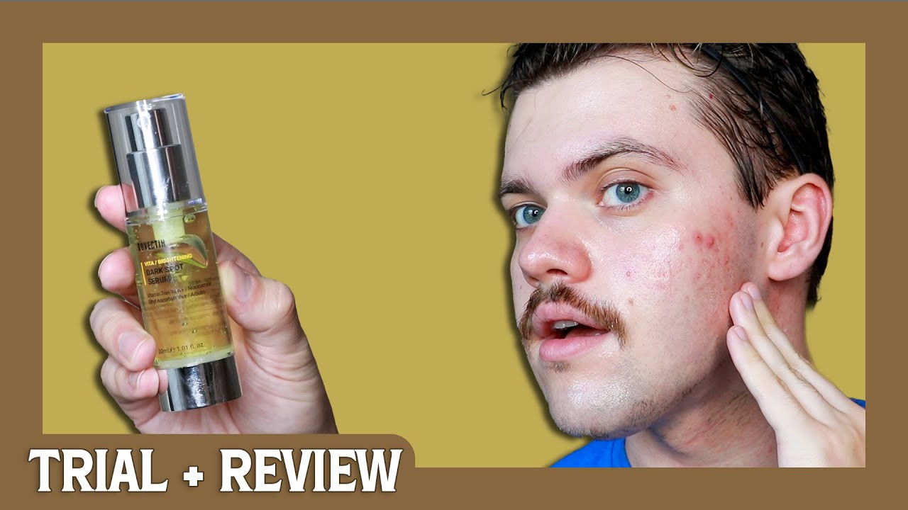 rovectin vita dark spot serum | trial + review