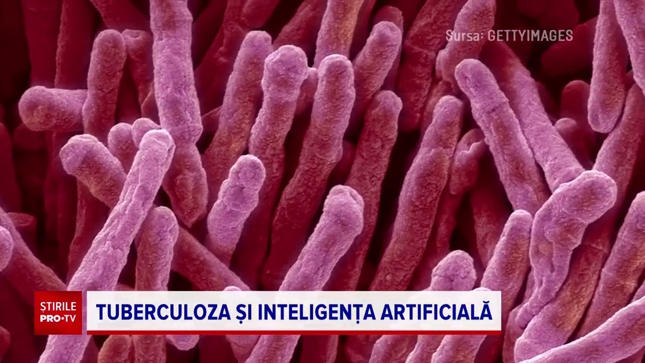 Un program creat de Spitalul Colentina pentru detectarea TBC, cumpărat cu o sumă uriașă