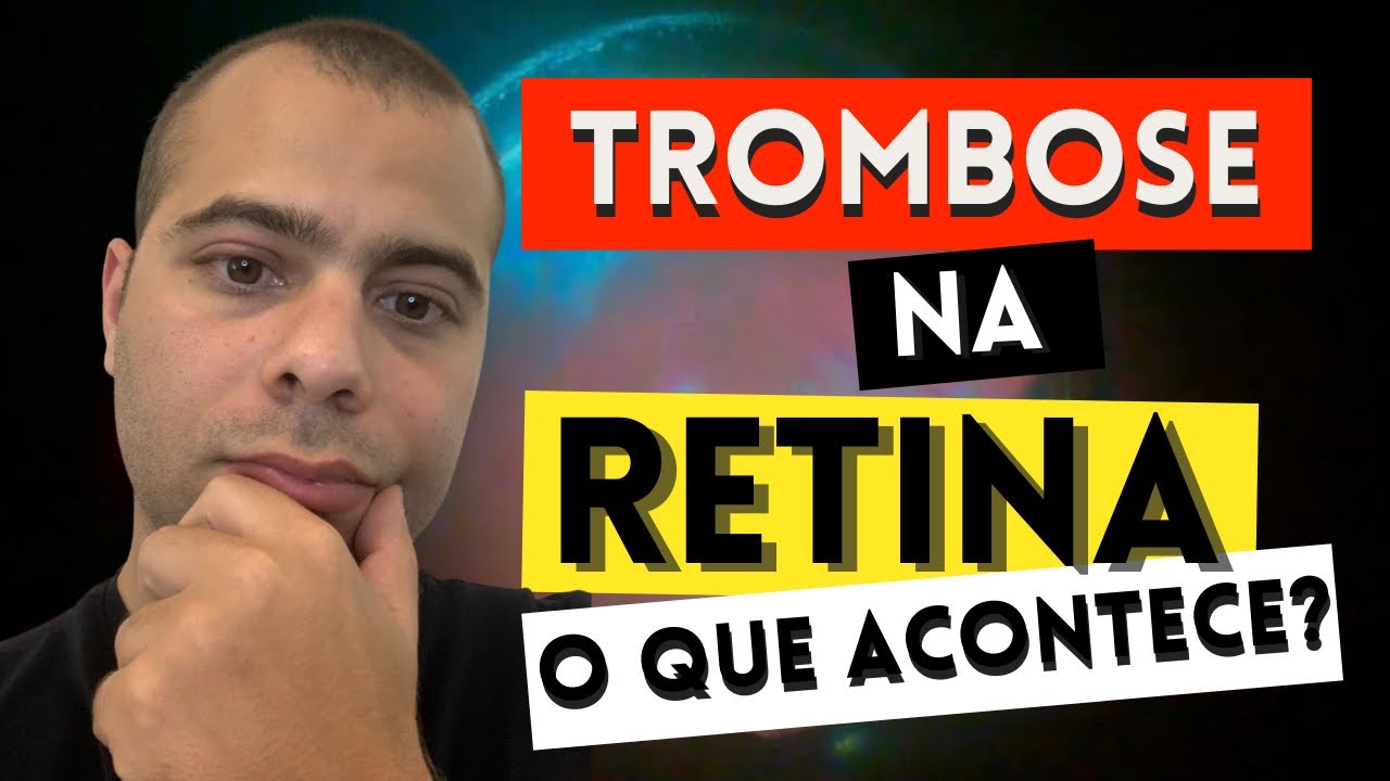 TROMBOSE NA RETINA / OCLUSÃO VENOSA DA RETINA / TROMBOSE OCULAR. O que é ? Sintomas e Tratamento