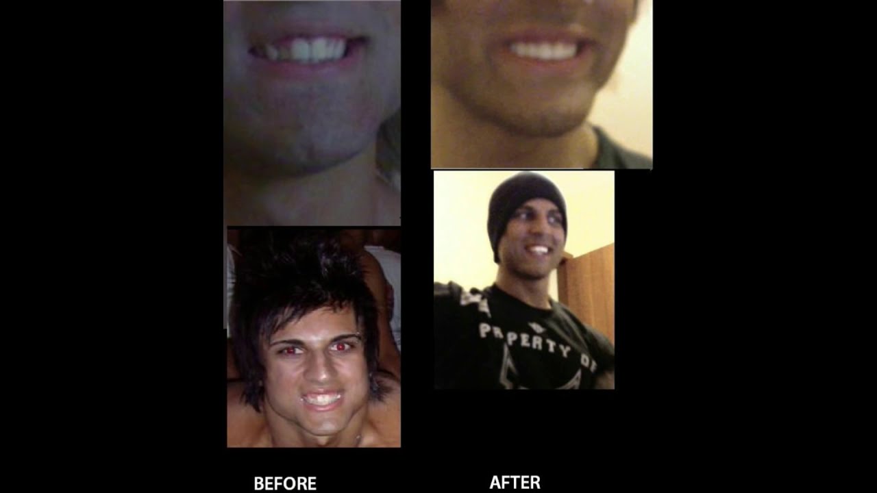 Zyzz - Rare Footage Part 3