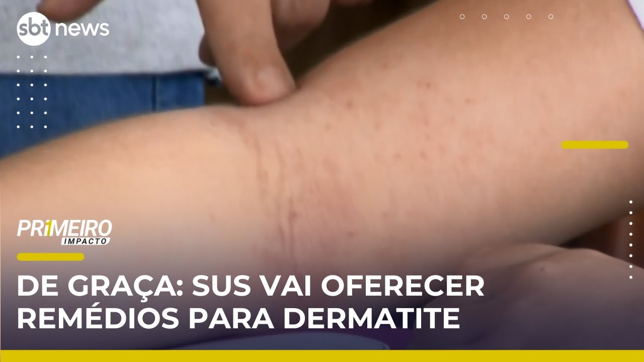SUS passa a oferecer tratamento gratuito para dermatite at&oacute;pica | Primeiro Impacto (06/06/25)