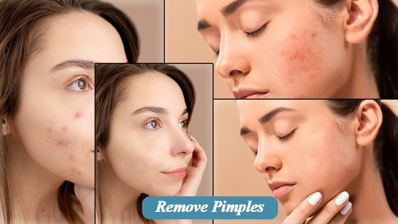 Remove Pimples From Face Using Spot Healing Brush In Photoshop | Beginner Tutorial Part 9