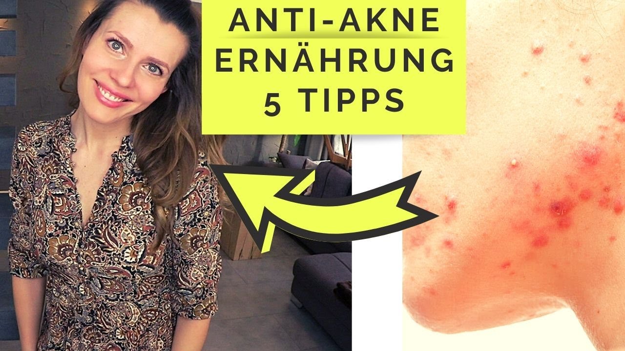 ERNÄHRUNG für REINE HAUT | GEGEN Akne, Pickel, Unreinheiten ⛔ loswerden bekämpfen & natürlich heilen