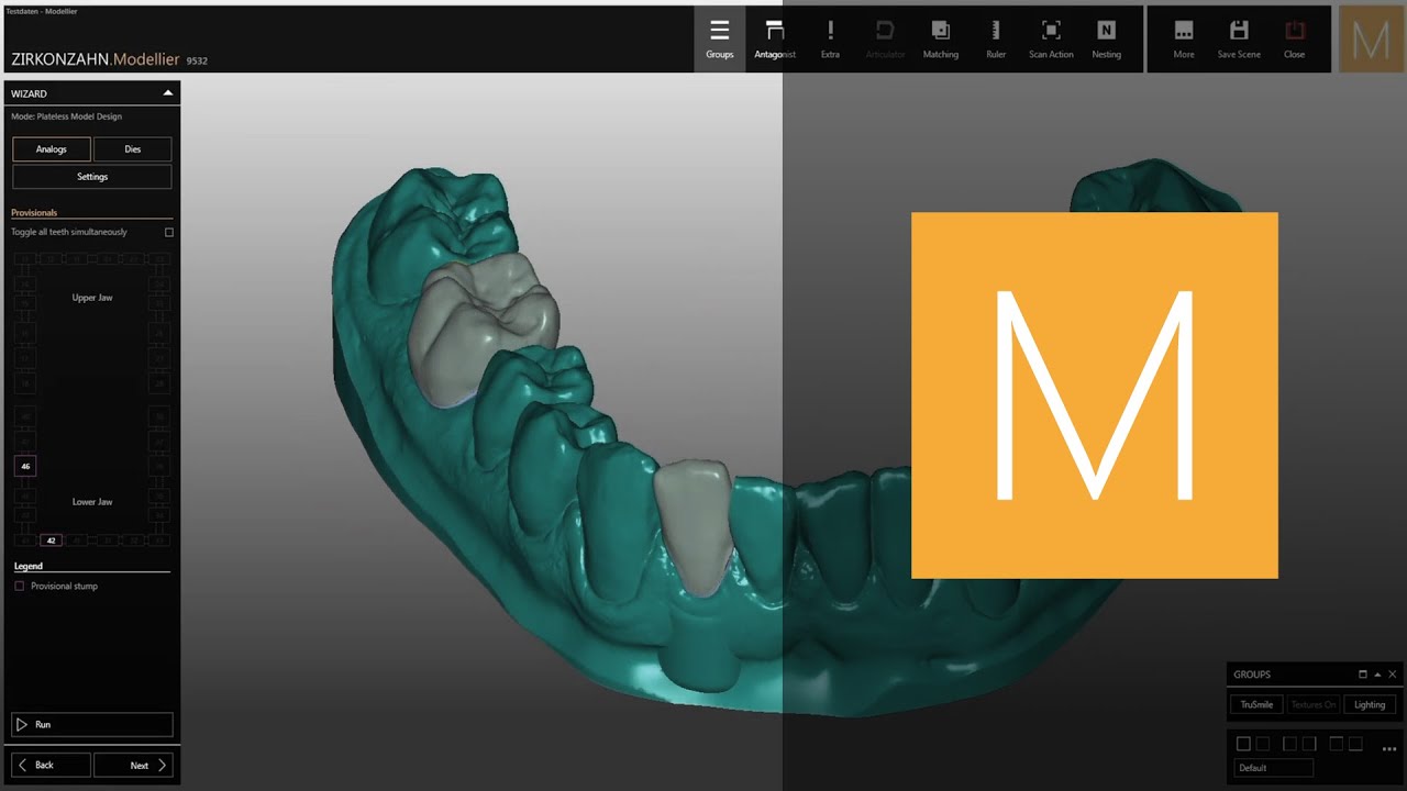 How to create a model with temporary crowns in Zirkonzahn.Modellier | Zirkonzahn.Software