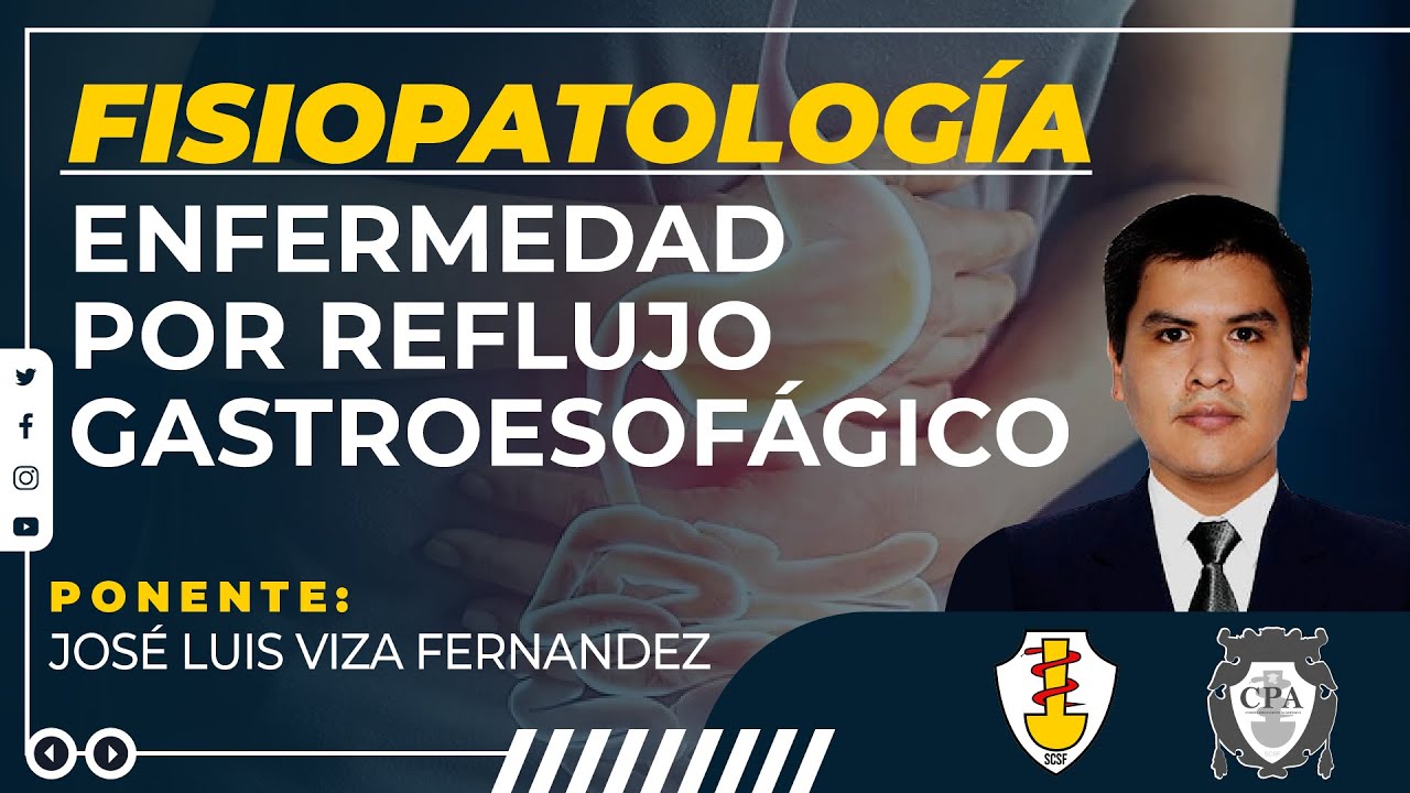 FISIOPATOLOGÍA: ENFERMEDAD POR REFLUJO GASTROESOFÁGICO - José Luis Viza Fernandez