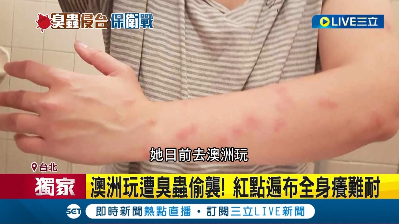 #三立獨家 肆虐港韓後肆虐台灣! 民眾控北市旅館驚見臭蟲蹤跡 臭蟲肉眼可見! 不幸遭咬