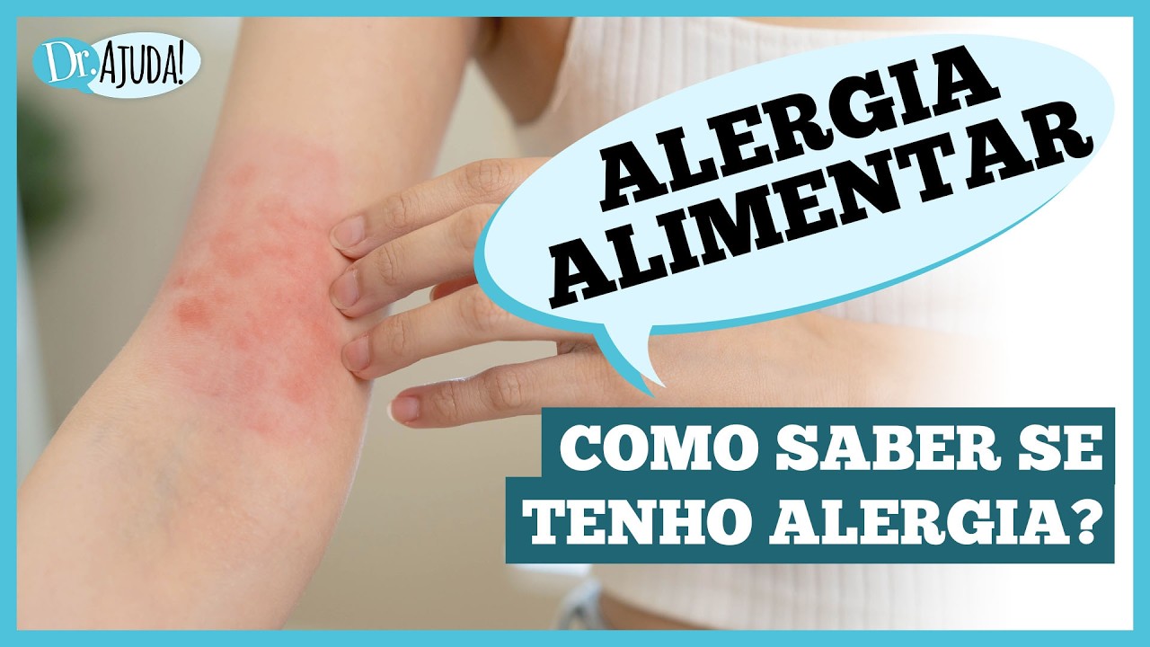 Você tem ALERGIA a algum ALIMENTO? Como identificar? #alergia #intolerancialactose
