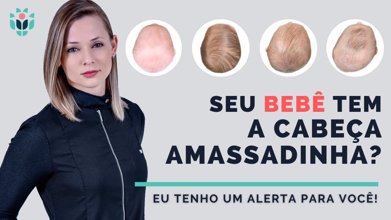 BEBÊ COM A CABEÇA AMASSADA É NORMAL?