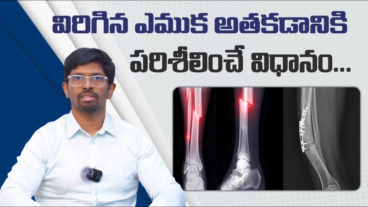 ఫ్రాక్షర్‌ని ఎలా పర్యవేక్షించాలి? || Fracture Monitoring in Telugu || Dr.Vamshis Orthopaedic Center