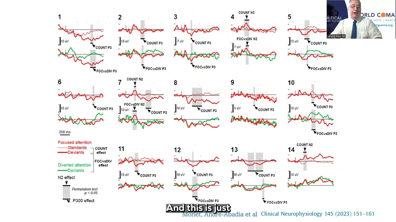 How to Get Started Using EEG to Assess Coma Patients for Covert Consciousness
