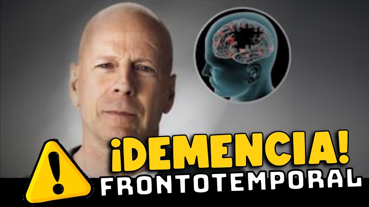 ¡CASO BRUCE WILLIS! ¿QUÉ ES LA DEMENCIA FRONTOTEMPORAL?