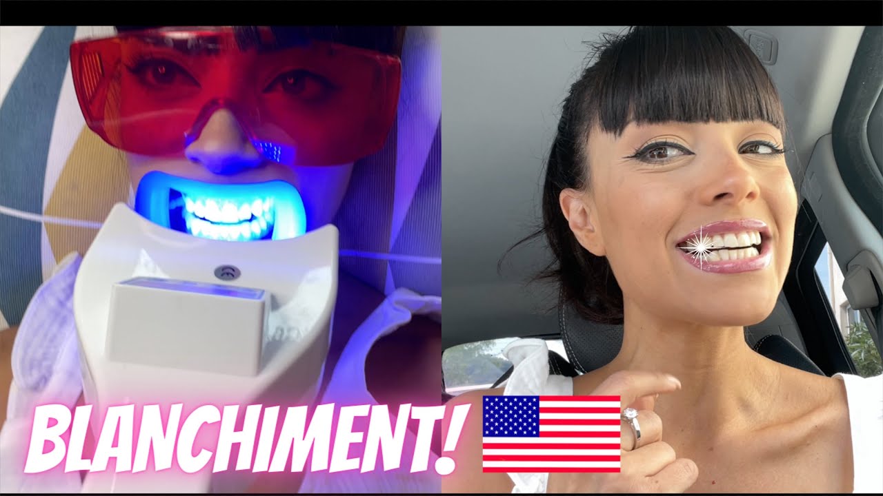 BLANCHIMENT DENTAIRE 🦷AMERICAIN🇺🇸