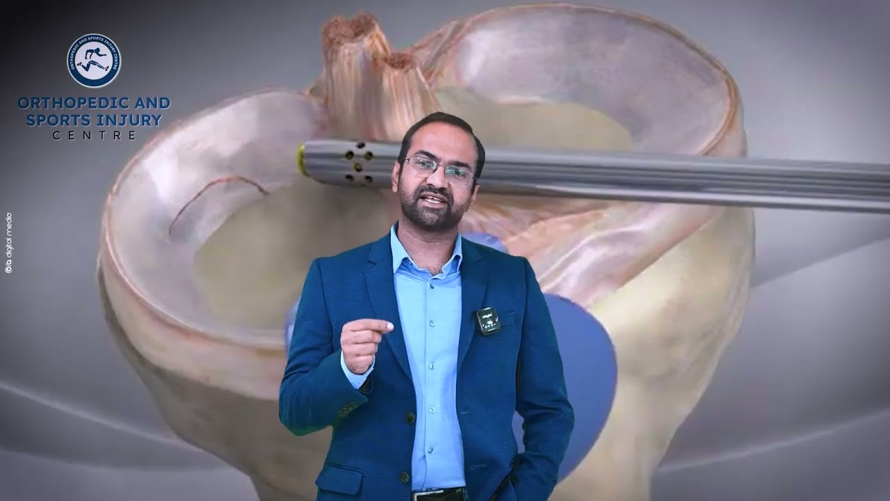 🦴 What is a Meniscus Injury? Dr Vivek Bansal Orthopaedic Sports Surgeon