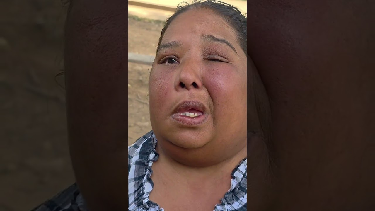 Me parte el corazón 💔😭ver a esta madre asi amigos hagamos algo entre todos 🙏🥺