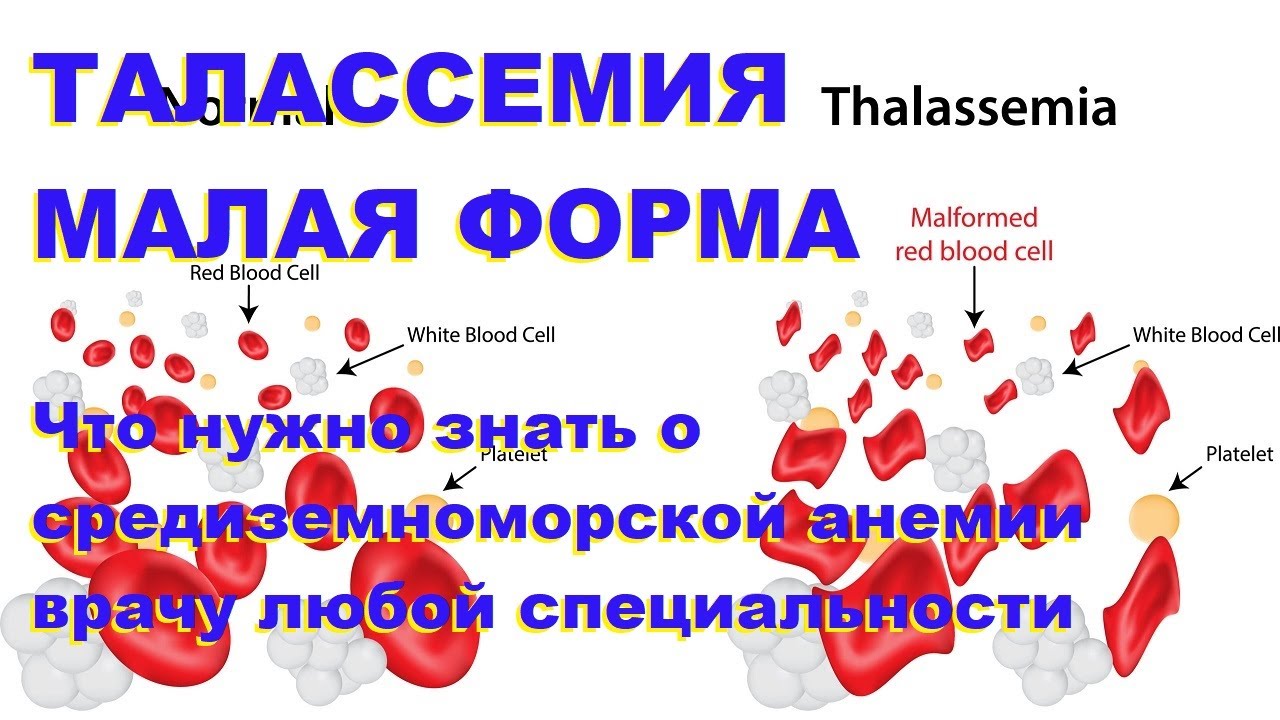 Талассемия, малая форма. Что нужно знать о средиземноморской анемии врачу любой специальности