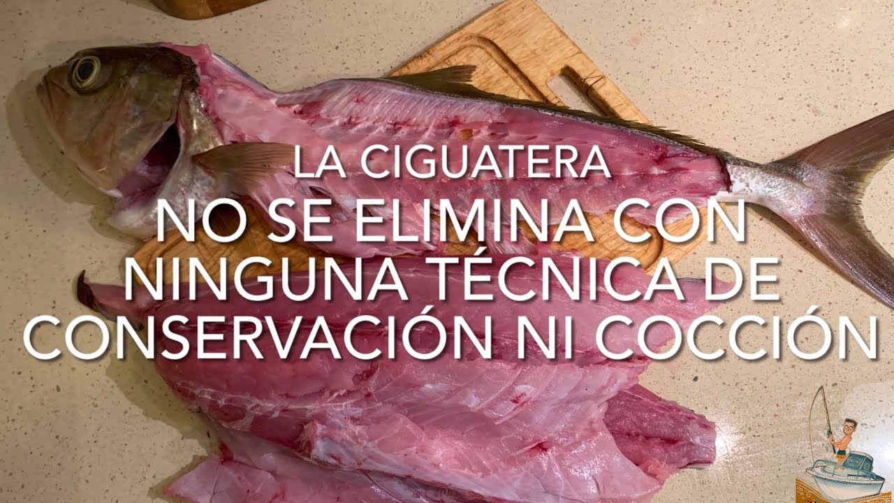 Intoxicación por ciguatera
