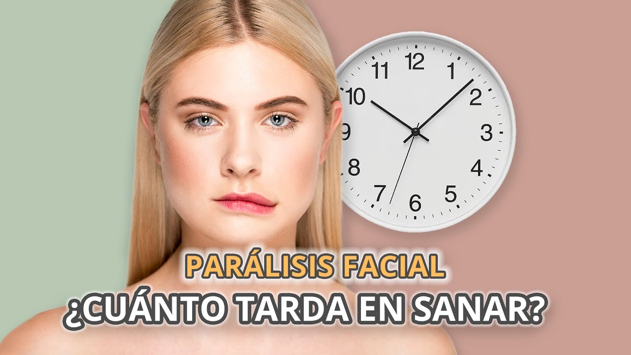 Parálisis facial ¿Cuánto tarda en sanar? ¿Es rápido?