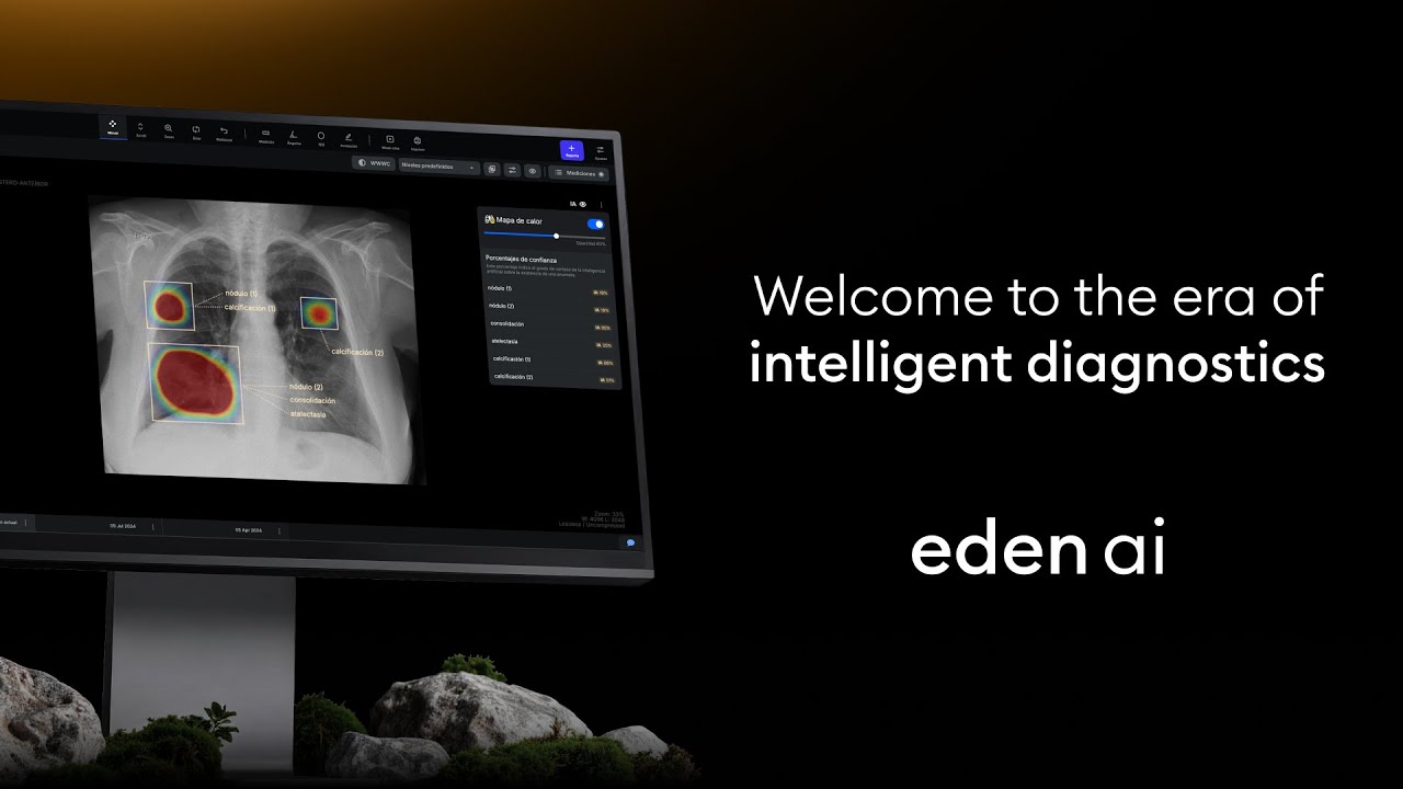 Meet Eden AI | The era of intelligent diagnosis