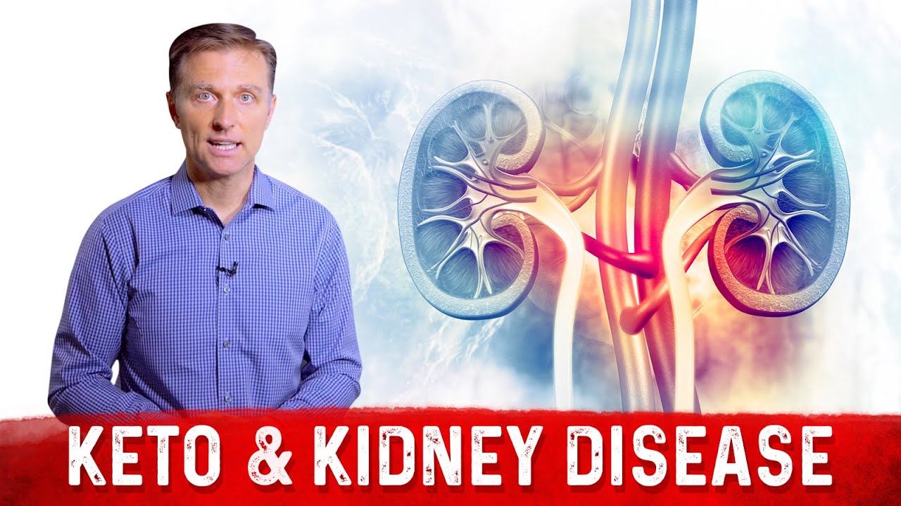 Keto Diet & Kidney Disease &ndash; Dr. Berg