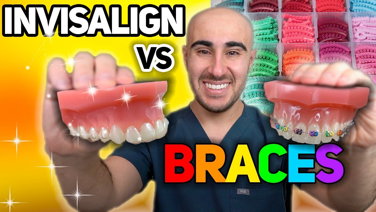 Брекеты против Invisalign: цена, зубная боль, скорость и т. д. — ПОЛНЫЙ обзор 🔥