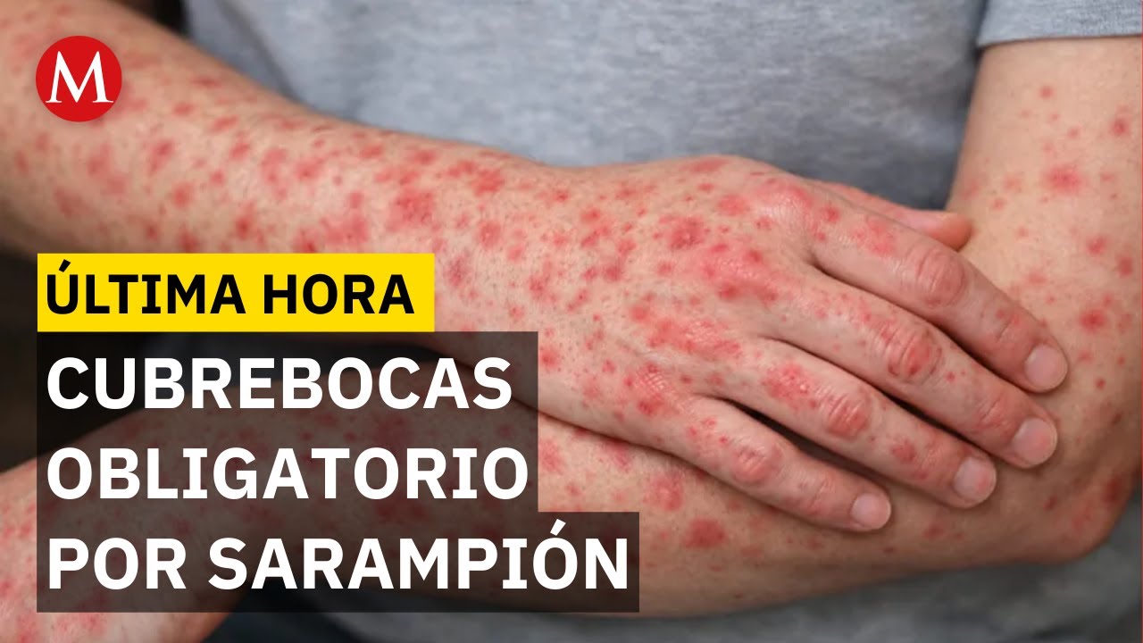 Imponen cubrebocas en escuelas por brote de sarampión en Jalisco