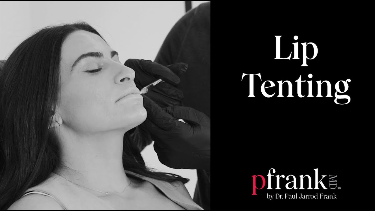 Lip Enhancement: How to Create Increased Lip Show with &ldquo;Lip Tenting&rdquo;