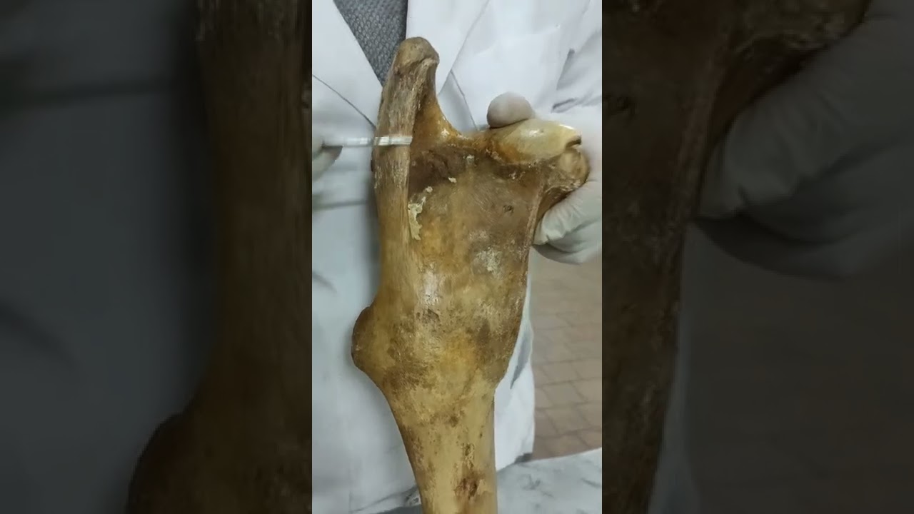 Femur comparative دكتور رمضان ساري