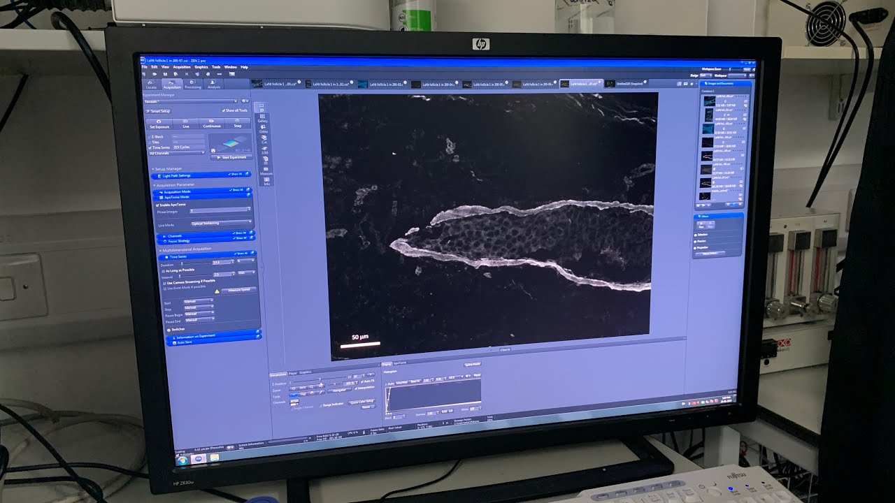 Using the apotome on a Zeiss epifluorescence microscope