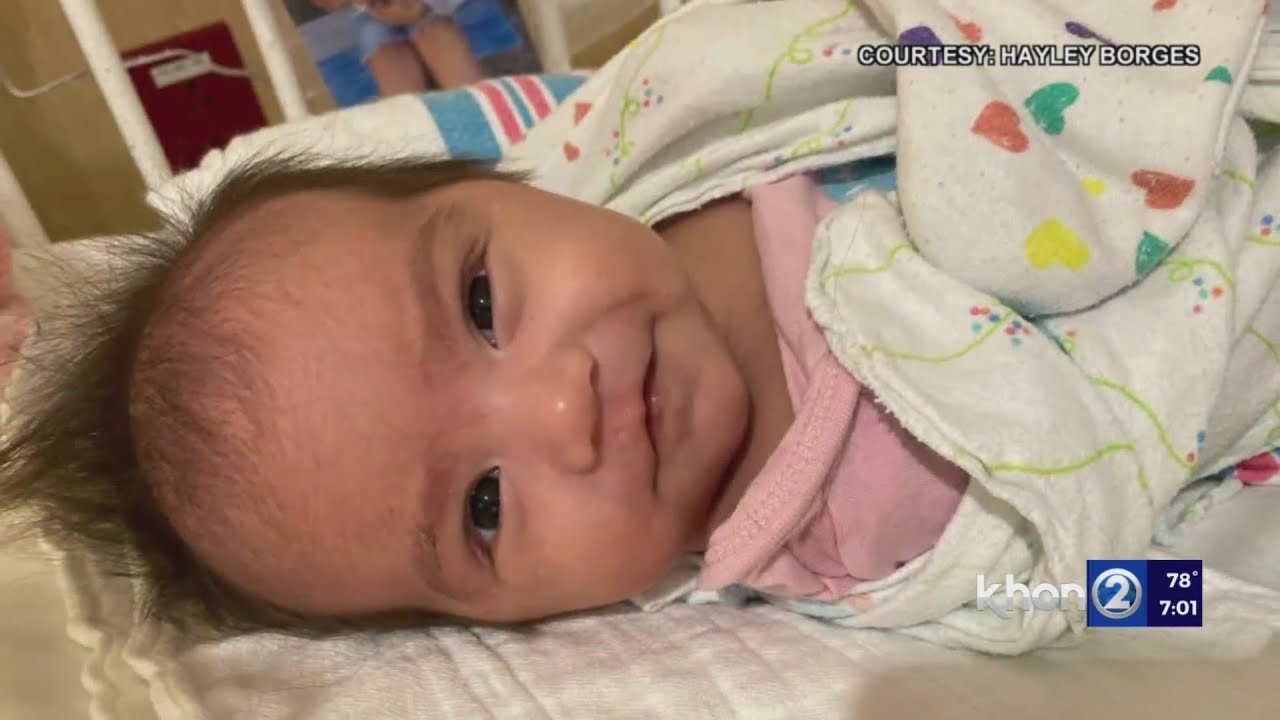 Kauai baby battling cancer, needs bone marrow transplant