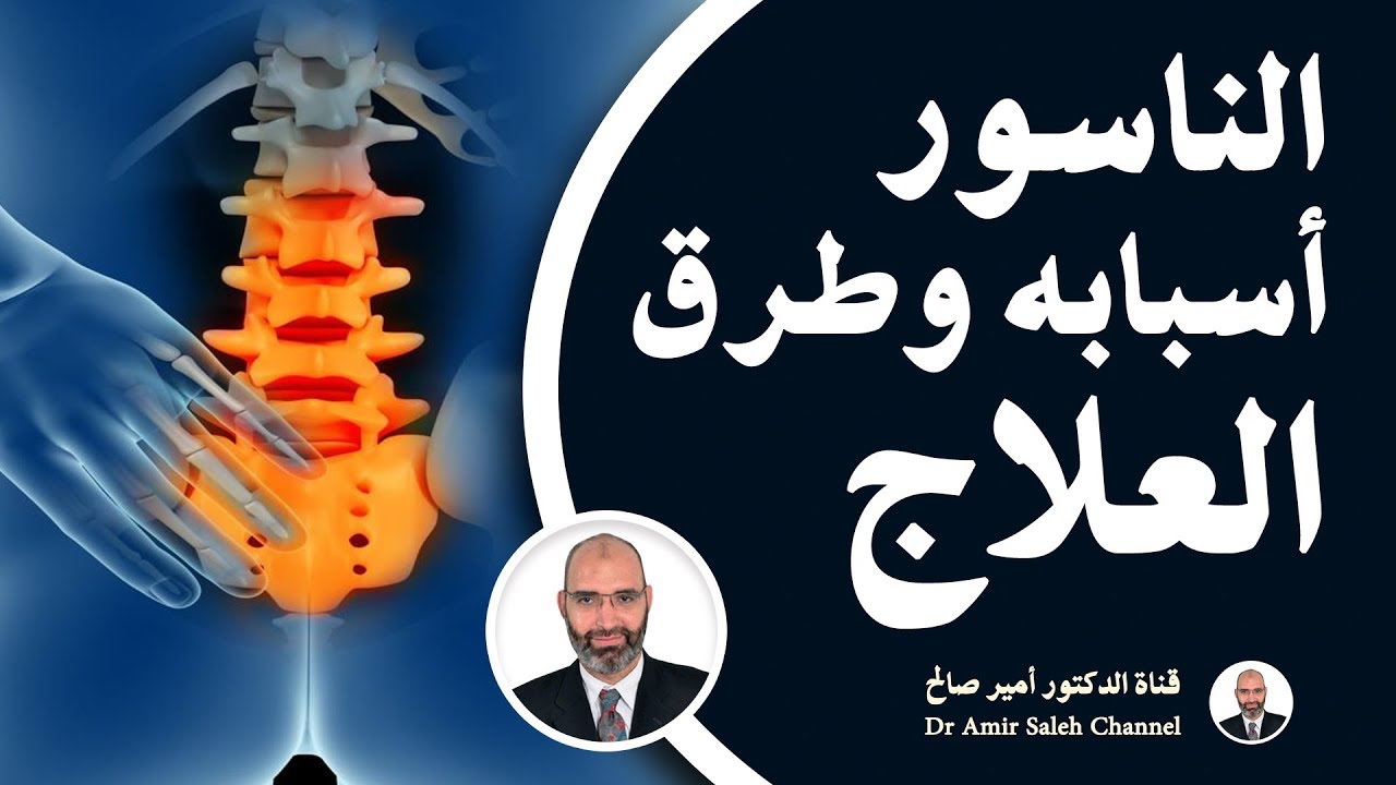 الناسور أسبابه وطرق العلاج | الدكتور أمير صالح | برنامج فنجان قوة