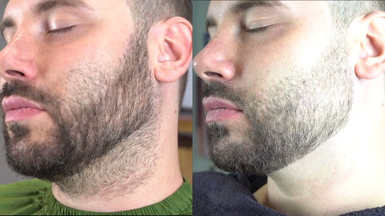 TUTORIAL: CÓMO ARREGLAR UNA BARBA CORTA (PASO A PASO)