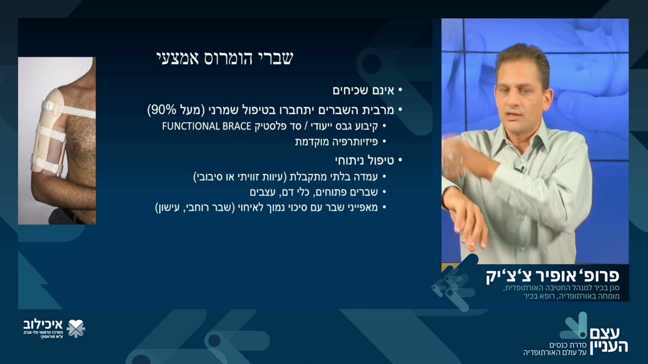 שברים בכתף פרופסור אופיר צ'צ'יק