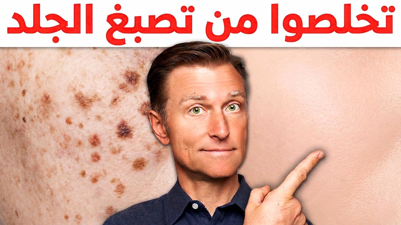 كذبوا وقالوا إنها بقع لا تزول