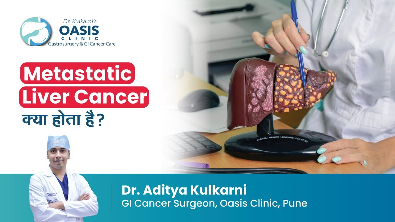 Metastatic Liver Cancer क्या होता है? | Dr Aditya Kulkarni | GI Cancer Surgeon