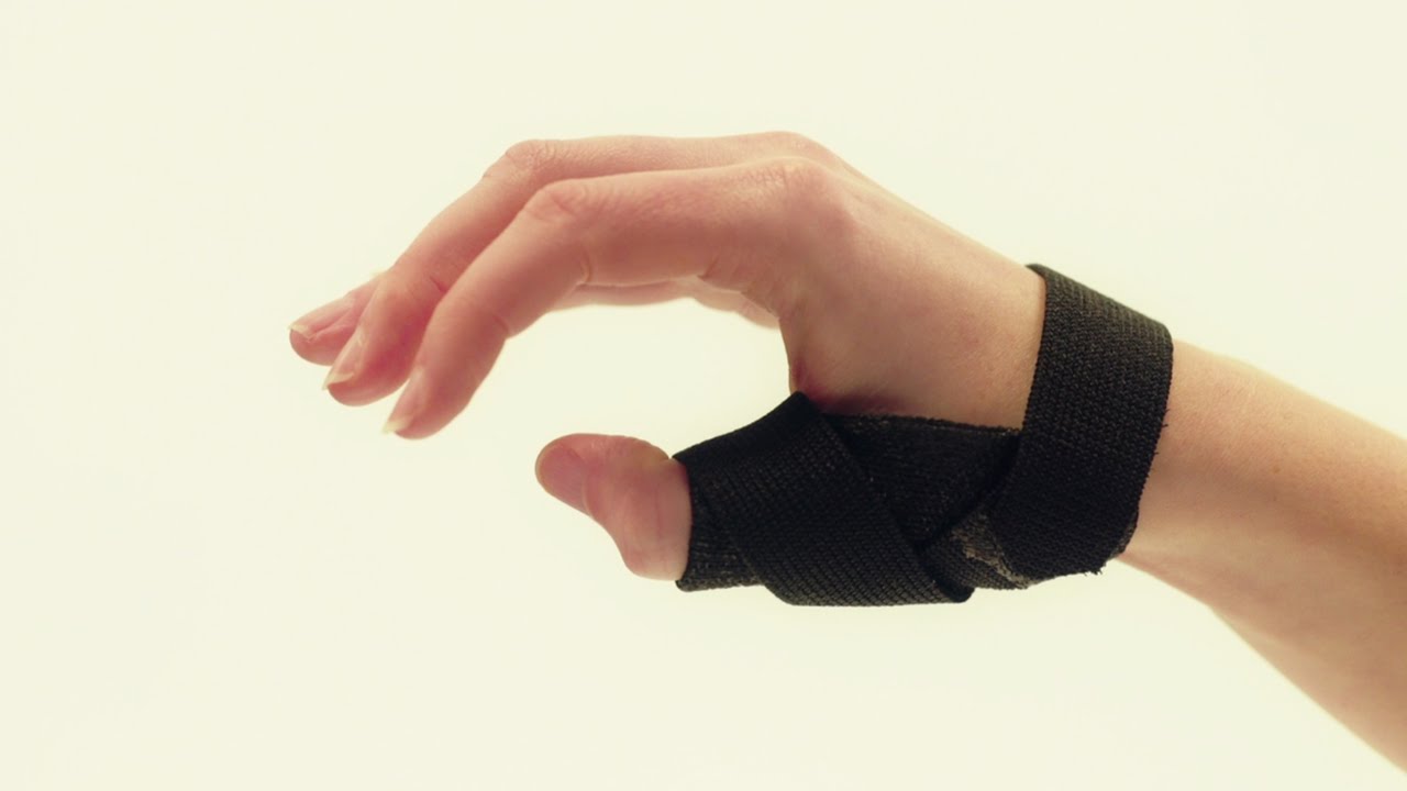 “Thumbs up” orthosis - Orficast Instructional Movie 8