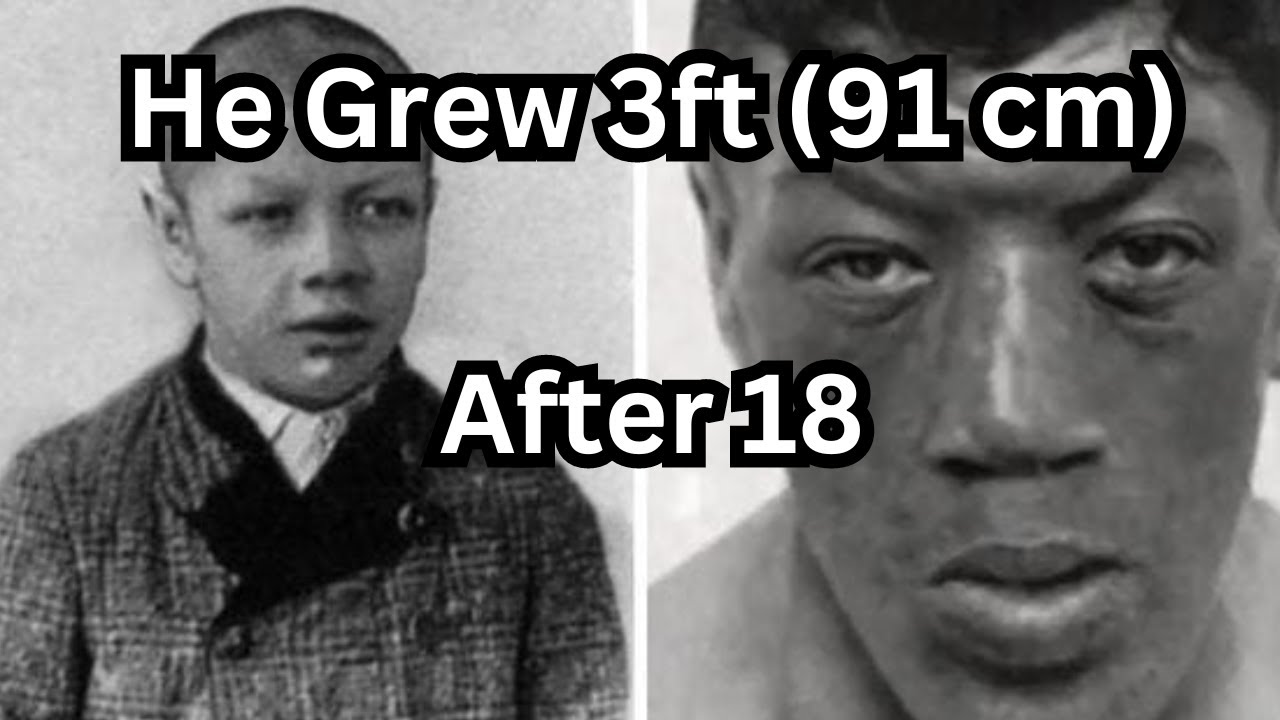 Do Growth Plates Ever Close? Adam Rainer's Dwarf-To-Giant Transformation