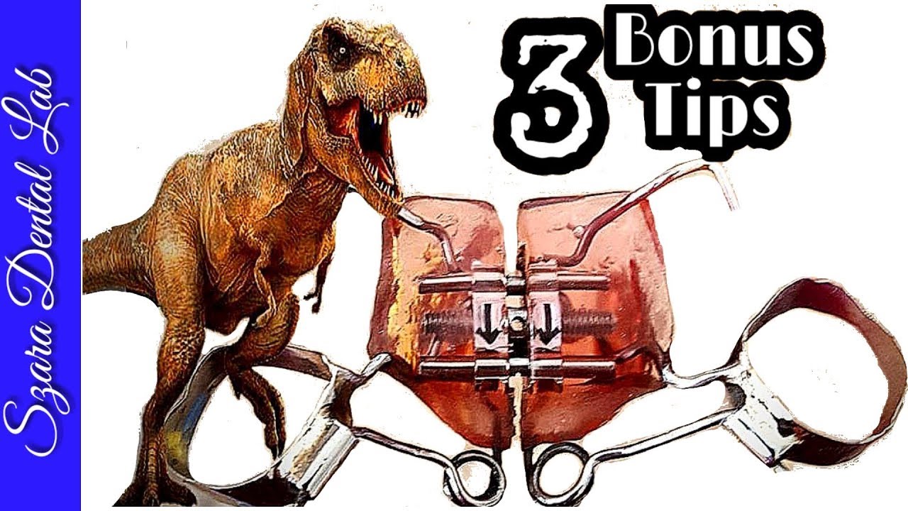 Distalizing Orthodontic Pendulum Appliance Lesson TREX